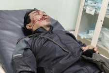 Camat Cicalengka Jenguk Awak Media Liputan 4 yang Mengalami Kecelakaan